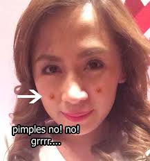 Natural remedy for pimple using almonds and milks