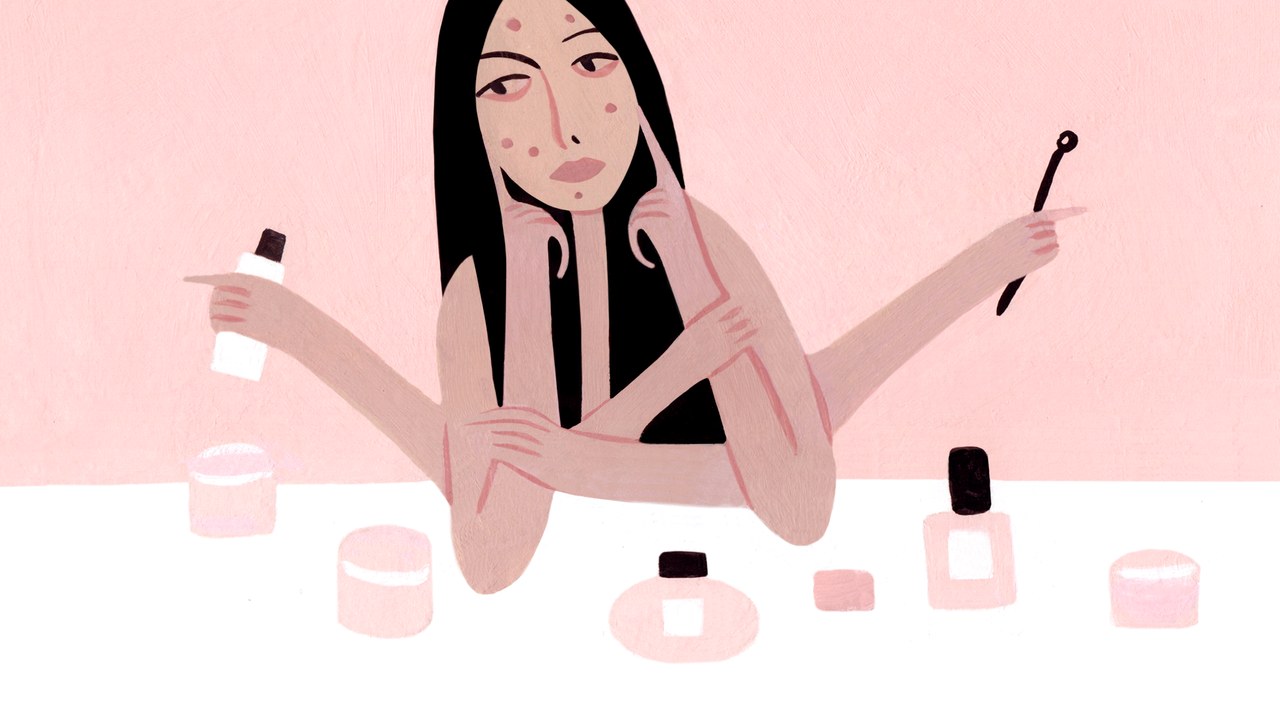 Acne: There are a lot of treatments to fight acne