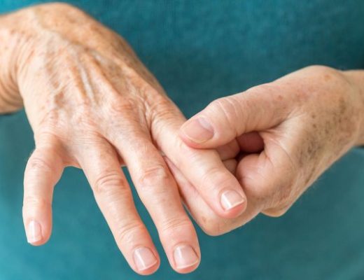 Home Remedies for Arthritis