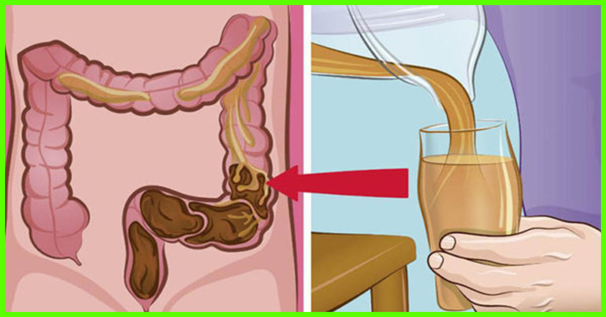 Home Remedies for Colon Cleansing