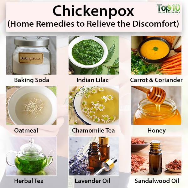 Home Remedies for Chickenpox
