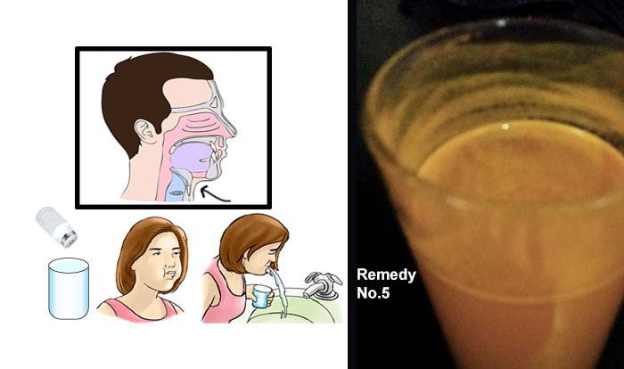 Home Remedies for Phlegm