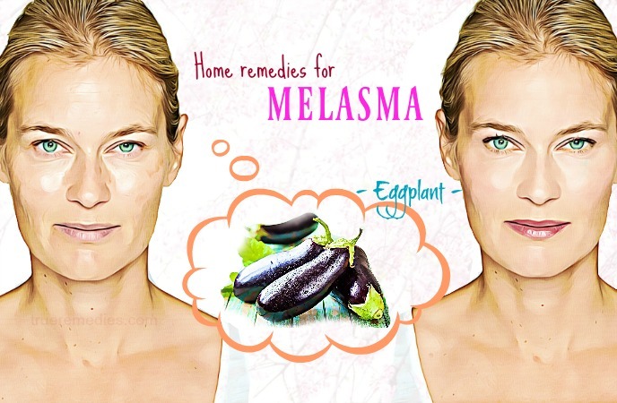 Home Remedies for Melasma