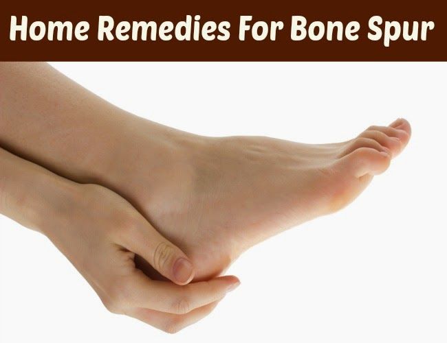 Home Remedies for Bone Spurs