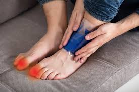 Home Remedies for Gout