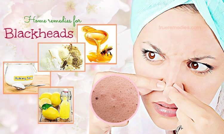 Home Remedies for Blackheads