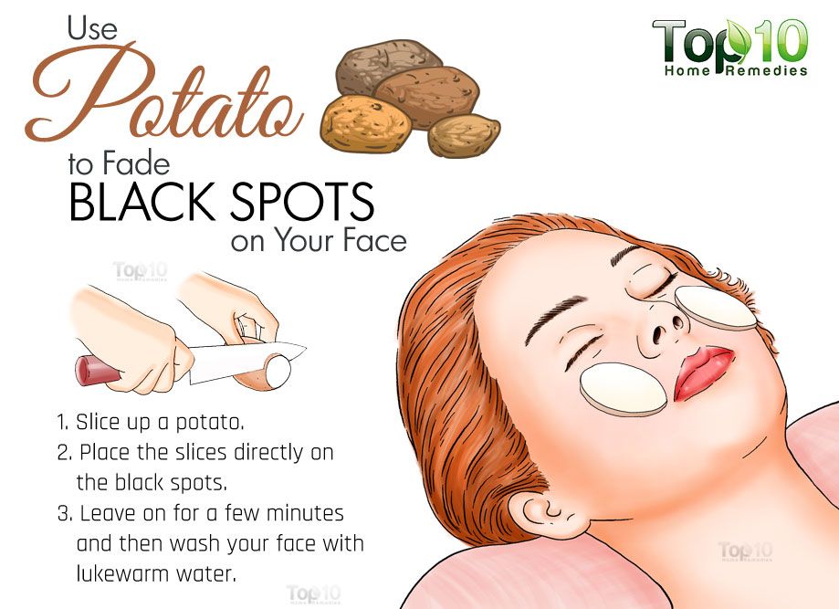 Home Remedies for Black Spots on Your Face