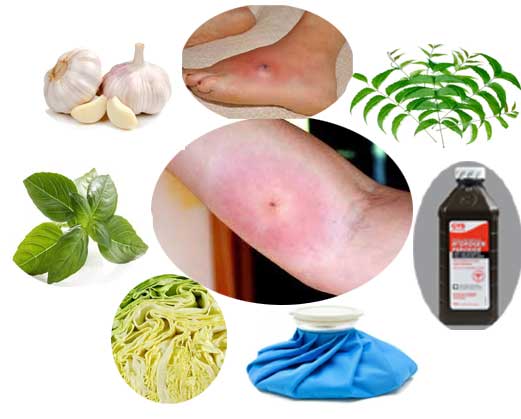 Home Remedies for Spider Bites