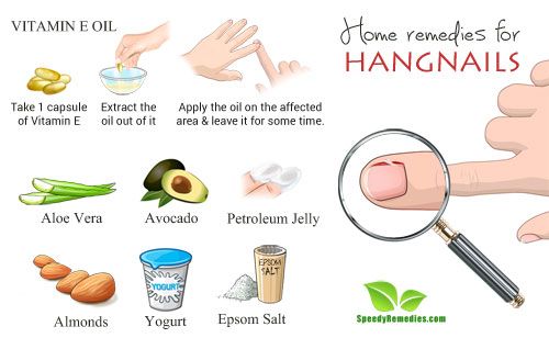 Home Remedies for Hangnails