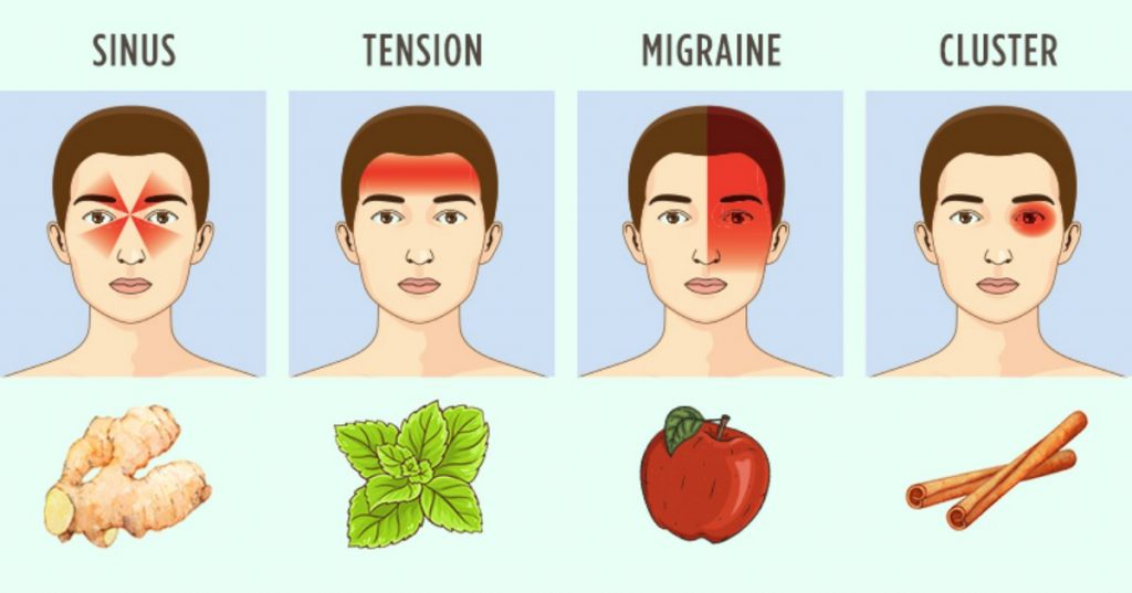 Home Remedies for Migraines