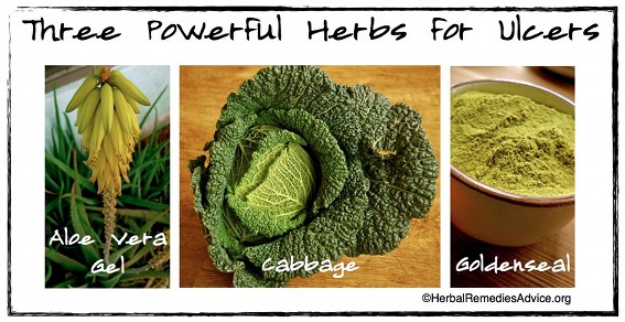 Home Remedies for a Stomach Ulcer