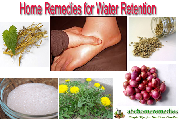 Home Remedies for Water Retention