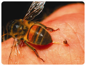 Home Remedies for Yellow Jacket Stings