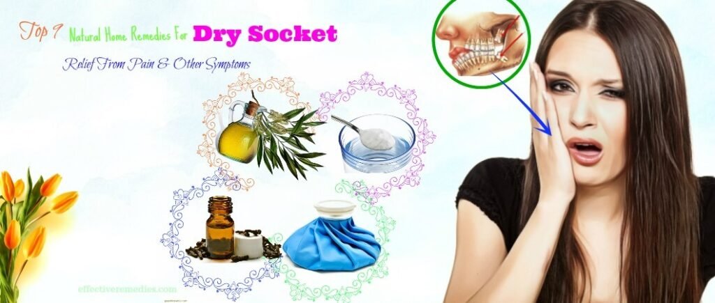 Home Remedies for Dry Socket