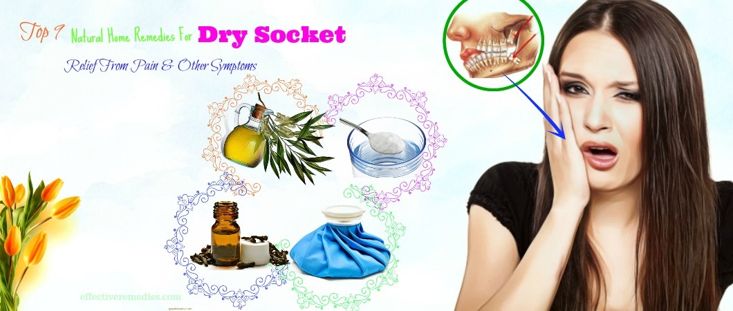 Home Remedies for Dry Socket