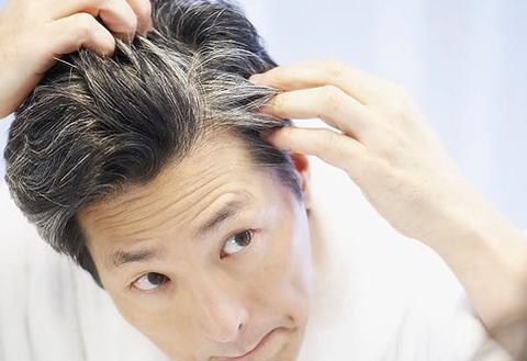 Home Remedies for Premature Graying of Hair