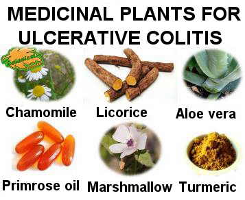 Home Remedies for Ulcerative Colitis