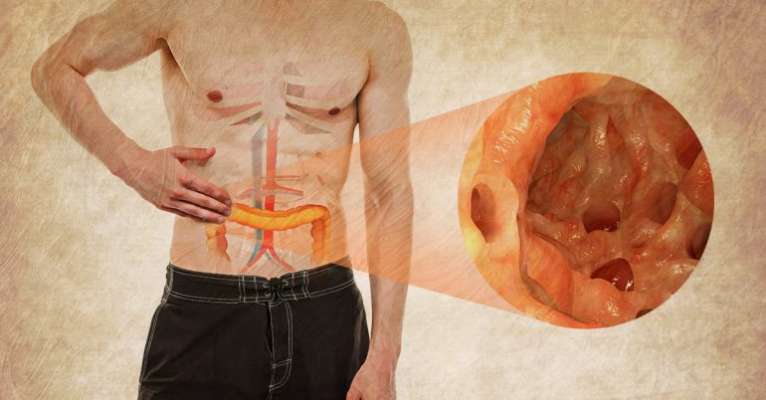 Home Remedies for Diverticular Disease and Diverticulitis