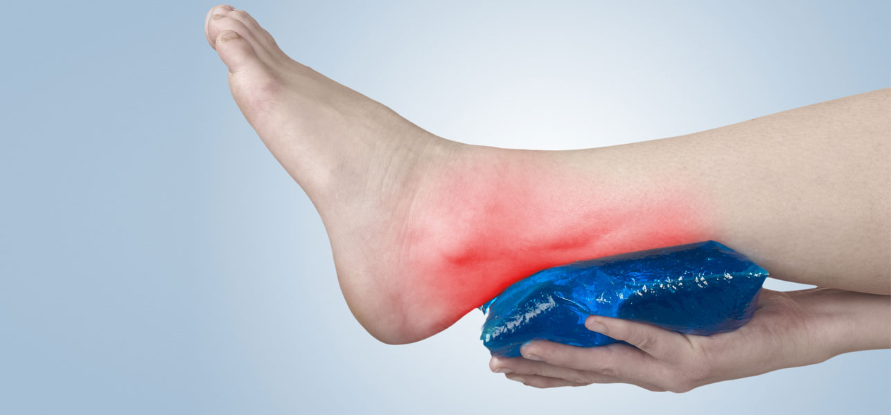 Home Remedies for Achilles Tendonitis
