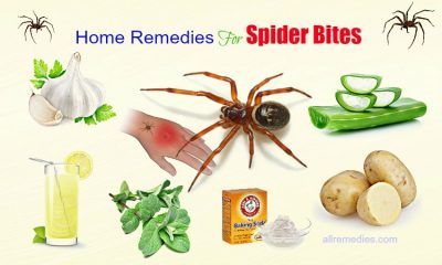 Home Remedies for Spider Bites