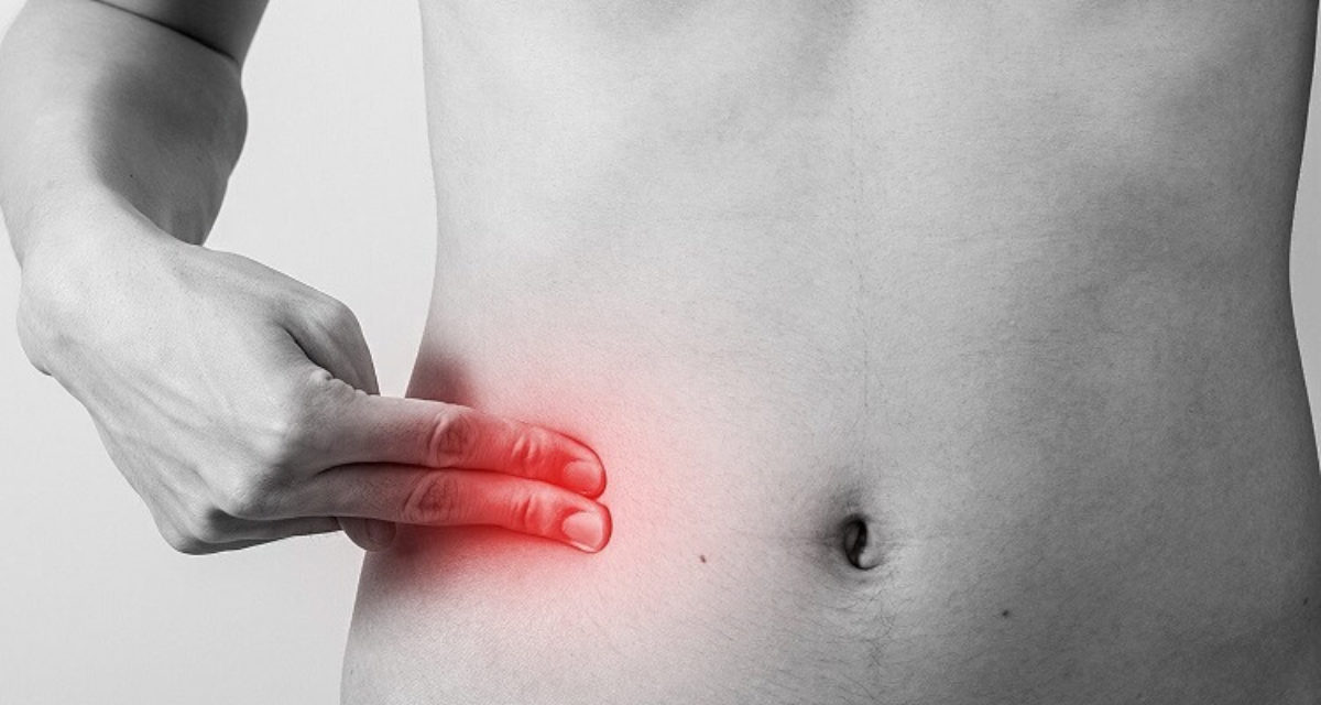 Home Remedies for Appendicitis