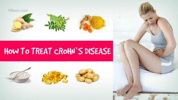 Home Remedies for Crohn’s Disease