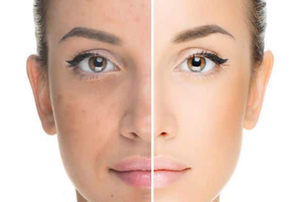 Home Remedies for Skin Rejuvenation