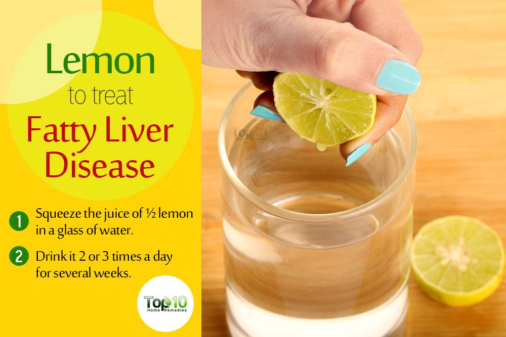 Home Remedies for Fatty Liver Disease