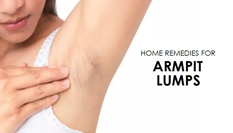 Home Remedies for Armpit Lumps