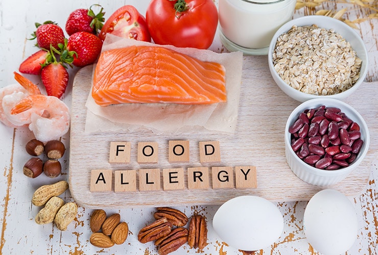 Home Remedies to Treat Food Allergies