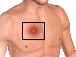 “Abscess Garlic Remedies: Using Garlic to Fight Infection Naturally”