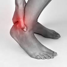 “Achilles Tendonitis Turmeric Remedies: Anti-Inflammatory Treatment Options”