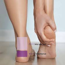 “Achilles Tendonitis Relief: Essential Oil Blends for Pain Reduction”