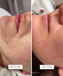 “Natural Anti-Aging Night Creams: Make Your Own Skincare at Home”