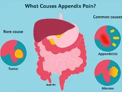 When the Ache Deepens: A Gentle Reflection on Appendicitis and Natural Soothing