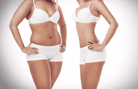 Home Remedies for Obesity & Weight Loss