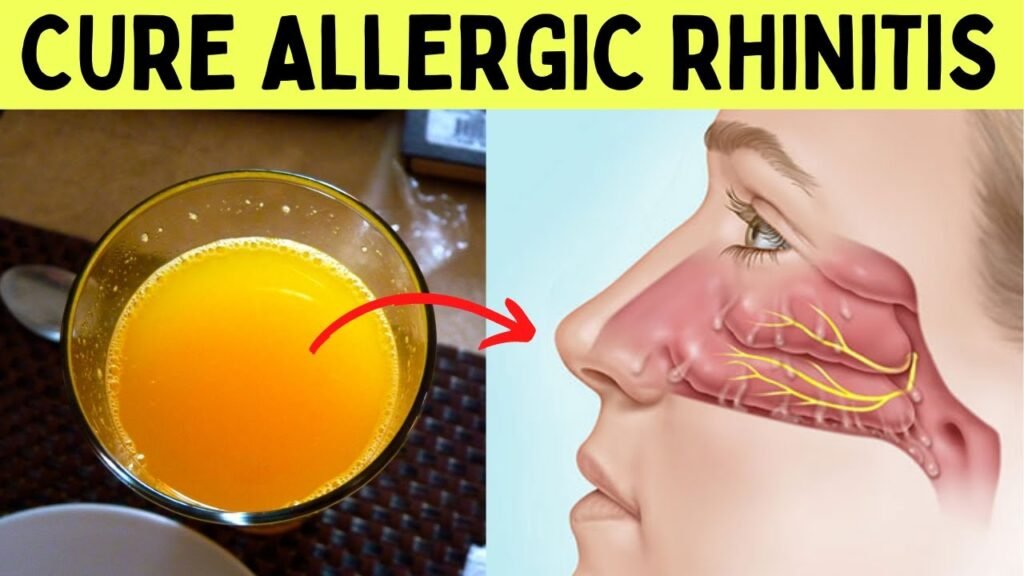 Home Remedies for Allergic Rhinitis: Natural Treatments to Relieve Symptoms Effectively