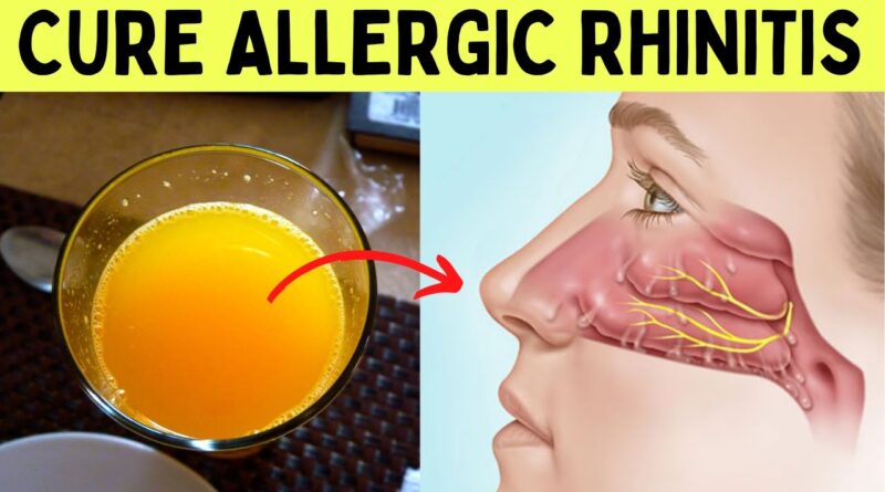 Home Remedies for Allergic Rhinitis: Natural Treatments to Relieve Symptoms Effectively