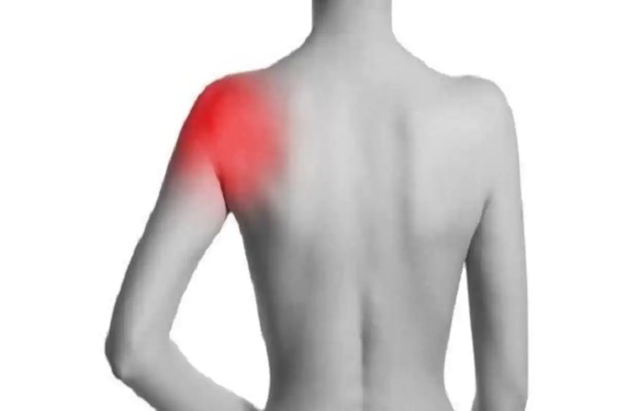 Home Remedies for Shoulder Pain